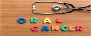 Oral cancer screening in Noida