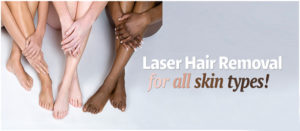 laser hair reduction in Noida