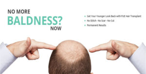 hair transplant