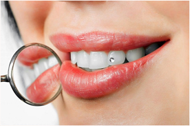 Tooth jewelry clinic in Noida