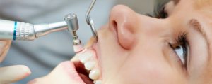 Orthodontic treatment in Noida