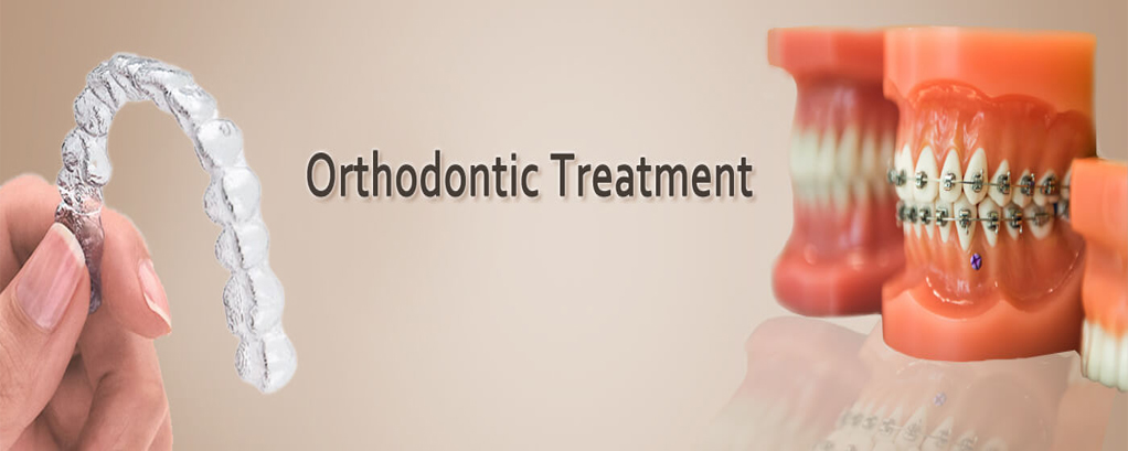 Orthodontic treatment in Noida