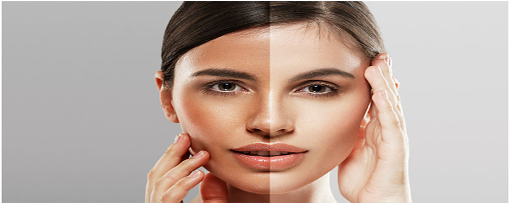 skin whitening treatment in Noida
