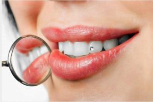 tooth jewelry woman teeth