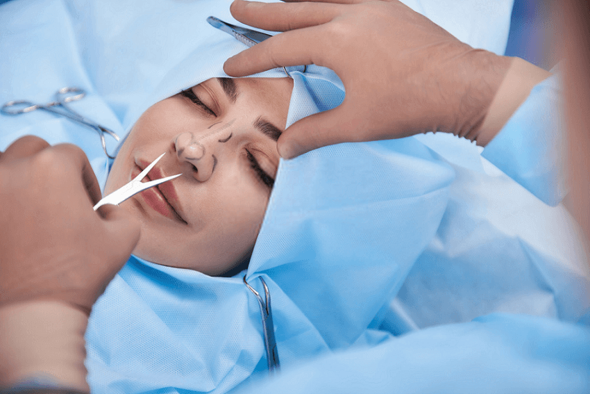 rhinoplasty surgery in Noida