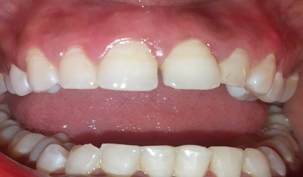 dental after