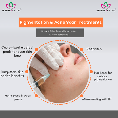 HydraFacial Boost - Enhanced Skin Treatment